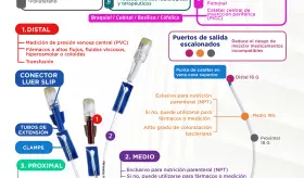Catéter venoso central | Infografía