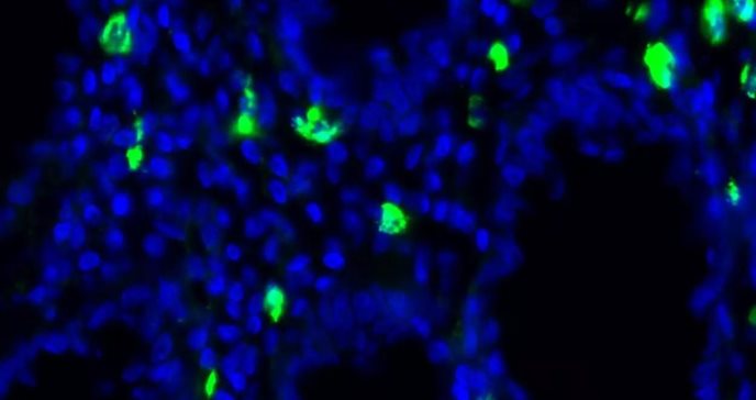 Identifican autoanticuerpo CXCR3 como un nuevo biomarcador para enfermedades cardiovasculares
