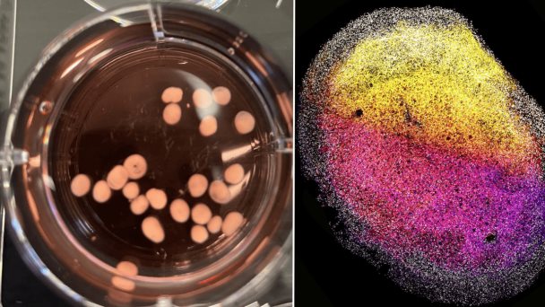 Crean minicerebros del tamaño de un grano de arroz a partir del tejido cerebral de un feto humano Crean minicerebros del tamaño de un grano de arroz a partir del tejido cerebral de un feto humano