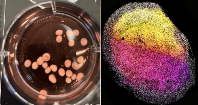 Crean minicerebros del tamaño de un grano de arroz a partir del tejido cerebral de un feto humano