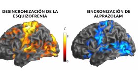 Esquizofrenia: Descubren afectación en neuronas inhibidoras que sería responsable de los síntomas