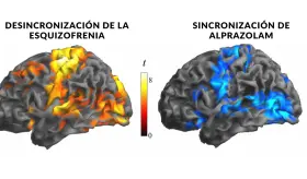 Esquizofrenia: Descubren afectaci&oacute;n en neuronas inhibidoras que ser&iacute;a responsable de los s&iacute;ntomas