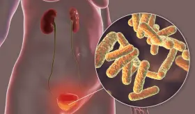 Cistitis recurrente no siempre es bacteriana y puede ser por vejiga hiperactiva o síndrome de dolor crónico