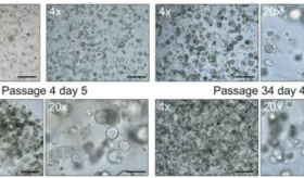 Cient&iacute;ficos desarrollan modelo de tejido ocular humano en 3D que produce sus propias l&aacute;grimas