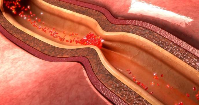 Buenos hábitos de sueño reducirían entre 12 y 22% el riesgo de desarrollar eventos cardiovasculares