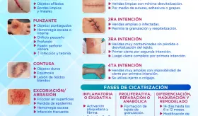 Heridas - clasificaciones | Infografía
