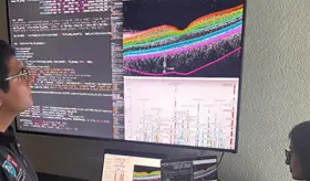 &iquest;Por qu&eacute; la retina puede actuar como indicador para detectar enfermedades cardiacas, metab&oacute;licas o demencia