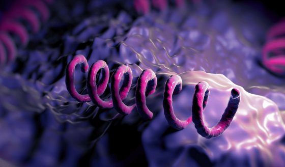 Las 3 etapas de la sífilis: chancros, erupción generalizada y daño óseo o cerebral permanente