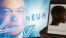 Elon Musk logra exitoso implante del primer chip de Neuralink en cerebro humano