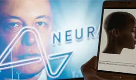 Elon Musk logra exitoso implante del primer chip de Neuralink en cerebro humano