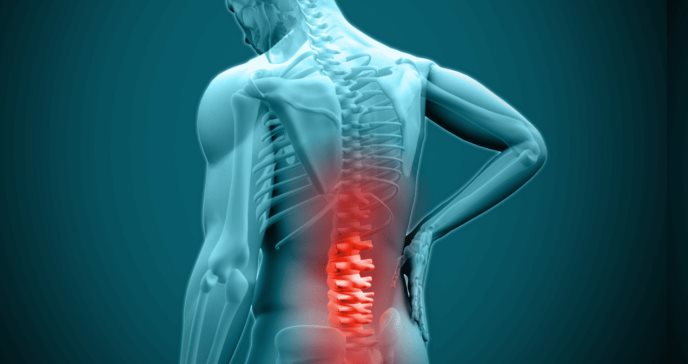 Lumbalgia crónica requiere tratamiento personalizado pues neuroestimulación y opiáceos no son efectivos
