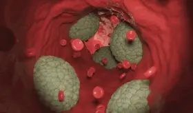 Uso de antiagregantes plaquetarios, estatinas y beta-bloqueantes en Enfermedad de las arterias coronarias