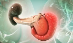 Pancreatitis aguda y las causas de un páncreas con inflamación severa