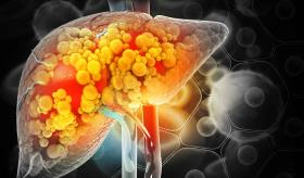 Descubren relación entre consumo de Vitamina A y menor riesgo de padecer del hígado graso no alcohólico