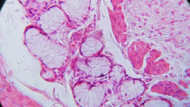 Investigadores crean mapa molecular detallado de la inflamación crónica del esófago