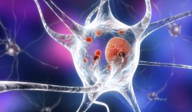 Descubren que fármaco anticanceroso ofrece nueva vía de tratamiento para Parkinson