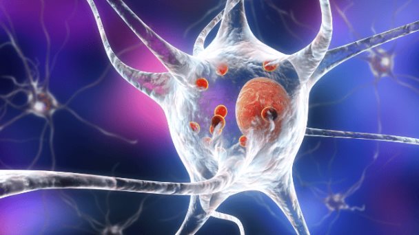 Descubren que fármaco anticanceroso ofrece nueva vía de tratamiento para Parkinson Descubren que fármaco anticanceroso ofrece nueva vía de tratamiento para Parkinson