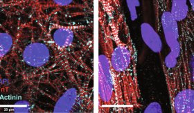 Científicos recrean células cardíacas de fibrilación auricular en un plato para descubrir nuevos fármacos