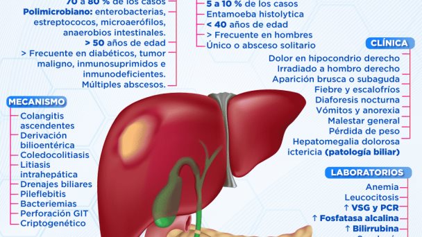 Absceso hepático | Infografía Absceso hepático | Infografía
