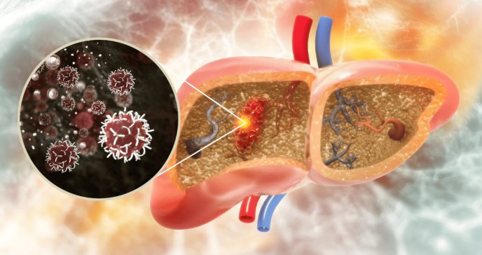 Desarrollan microrobots guiados por resonancia magnética para tratar tumores hepáticos