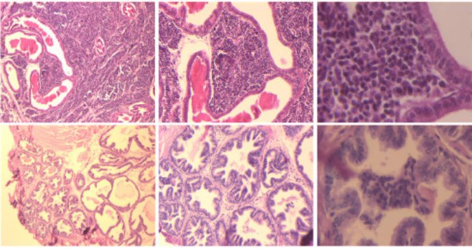 Descubren subproducto del aceite de sándalo, lawsona, que previene desarrollo de cáncer de próstata