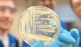Crean antibiótico sintético "super-asesino" de última generación para enfrentar bacterias resistentes