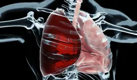 ¿Qué es el hemotórax y por qué una disonancia en la función pulmonar exige respuesta inmediata?