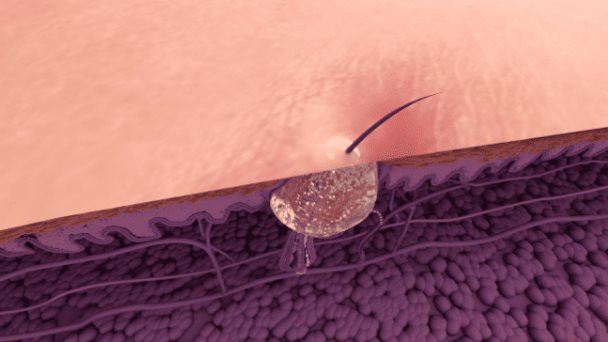 Descifrando el misterio de la “Zona T”: ¿Por qué hay un área del rostro con más producción de sebo? Descifrando el misterio de la “Zona T”: ¿Por qué hay un área del rostro con más producción de sebo?