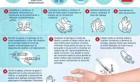 Buenas prácticas y técnica de extirpación de sangre arterial | Infografía