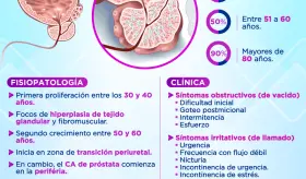 Hiperplasia prostática benigna