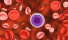 Seguimiento periódico de la leucemia linfocítica es más esencial que el propio tratamiento