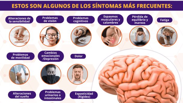 Comprendiendo los síntomas de la esclerosis múltiple | Infografía Comprendiendo los síntomas de la esclerosis múltiple | Infografía
