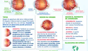 D&iacute;a mundial del glaucoma | Infograf&iacute;a
