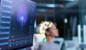 Descubren tratamiento no invasivo con ondas gamma para proteger al cerebro de efectos de la quimioterapia