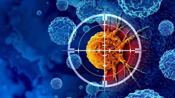 La hipertermia locorregional o calor controlado sería un aliado clave en la lucha contra tumores y cáncer La hipertermia locorregional o calor controlado sería un aliado clave en la lucha contra tumores y cáncer
