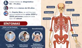 Mieloma múltiple | Infografía