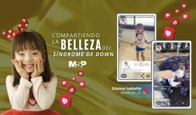 Compartiendo la belleza del Síndrome de Down - #ExclusivoMSP