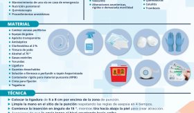 Instalación de vías venosas periféricas | Infografía