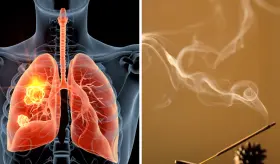 Exposición continua a incienso aumentaría el riesgo de cáncer de pulmón, leucemia o tumores cerebrales