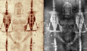 Análisis médico de las lesiones traumato-ortopédicas descubiertas en el Manto de Turín