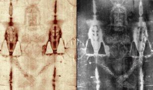 Análisis médico de las lesiones traumato-ortopédicas descubiertas en el Manto de Turín