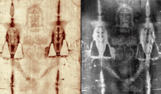 Análisis médico de las lesiones traumato-ortopédicas descubiertas en el Manto de Turín