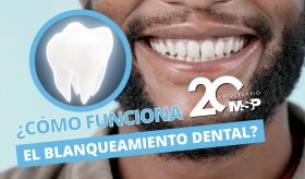 ¿Cómo funciona el blanqueamiento dental? - #ExclusivoMSP
