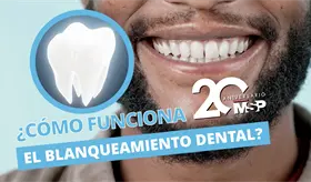 ¿Cómo funciona el blanqueamiento dental? - #ExclusivoMSP