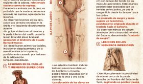 Manto de Turín: Análisis médico de las lesiones traumoto-ortopédicas | Infografía