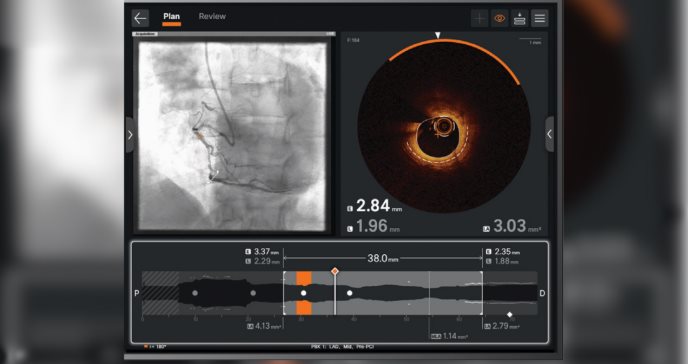 Ultreon 2.0: Revolucionaria tecnología de IA para combatir enfermedades cardiovasculares en Puerto Rico