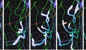 Crean "doble" del cerebro para probar medicina personalizada en trastornos psiquiátricos y neurológicos