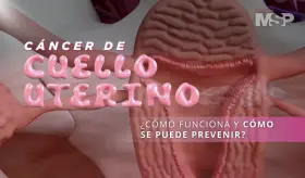 Cáncer de Cuello Uterino: ¿Cómo funciona y cómo se puede prevenir? - #EspecialMSP