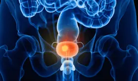 Así es la cistectomía o extirpación quirúrgica de la vejiga y otros tratamientos para el cáncer de vejiga