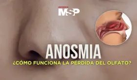 Anosmia: ¿Cómo funciona la pérdida del olfato? - #ExclusivoMSP